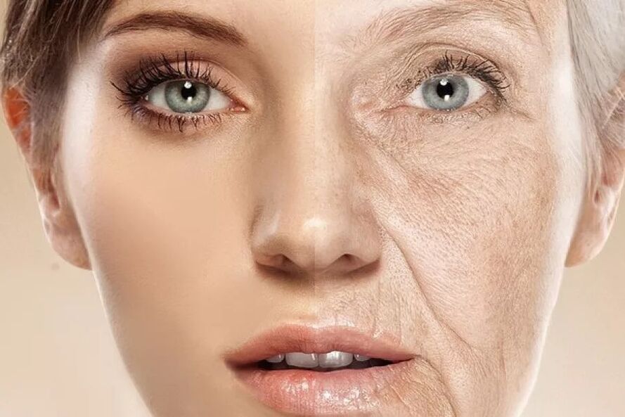 Piel facial antes y después de la exposición al láser ablativo fraccionado
